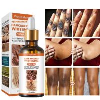 +2771 073 2372 Get Rid Of Vitiligo In Squirrel Mountain Valley In California, United States