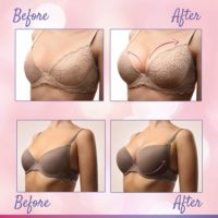 +27710732372 Breast Enlargement/Lifting Products In Tanapag In Saipan, Northern Mariana Islands