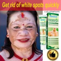 Get Rid Of Vitiligo And Tattoos In Agana Heights Village in Guam Call +27710732372